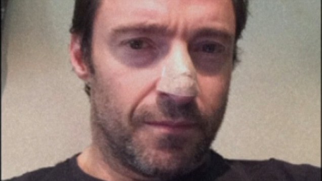 Hugh Jackman